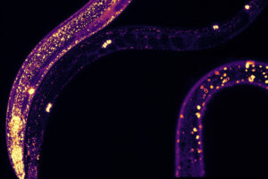 La nueva esperanza contra el Alzheimer es una simple proteína. Lo hemos descubierto gracias a un diminuto gusano