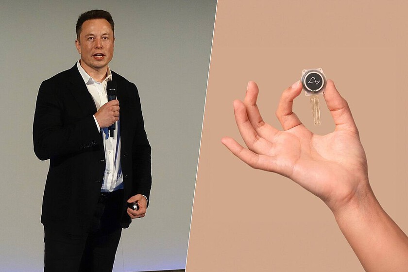 El primer humano con un implante de Neuralink se recupera bien. Y controla el ratón del PC con sus pensamientos