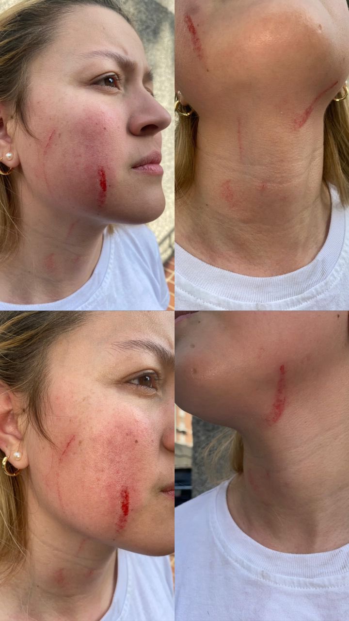 Bernabé Gutiérrez rechaza agresiones en contra de la diputada Anyelith Tamayo en El Valle