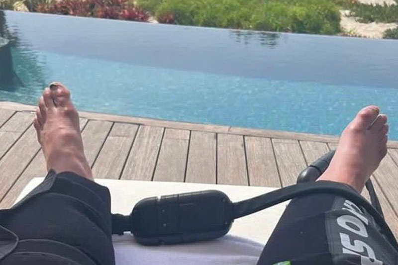 Impactante imagen de los pies de Cristiano Ronaldo enciende las redes