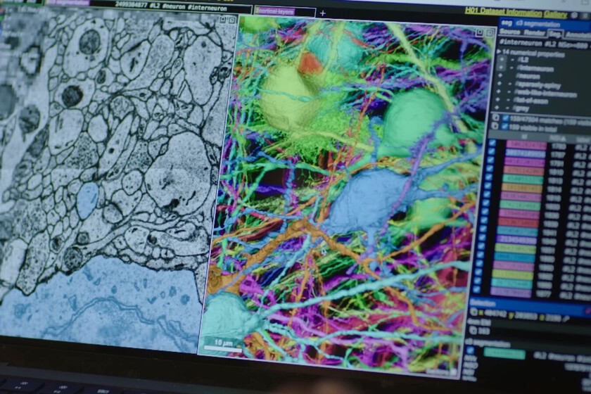 Mapear el cerebro humano es imposible con la tecnología actual. Google quiere lograrlo empezando con el de los ratones