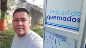 Murió tras un mes de agonía