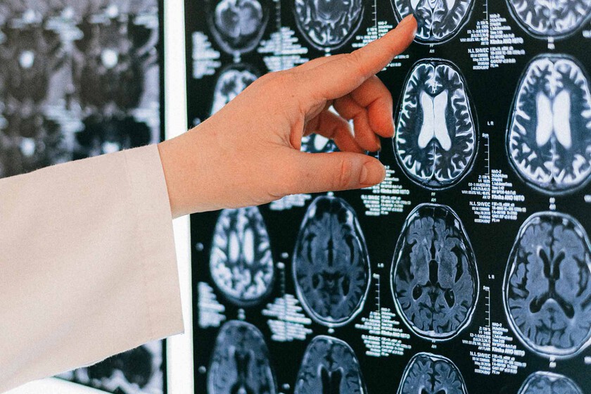 Nuestro cerebro tiene su propia copia de seguridad. Ya se conoce cómo crea copias en paralelo de cada recuerdo