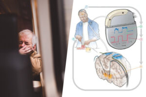 un “marcapasos” para el cerebro