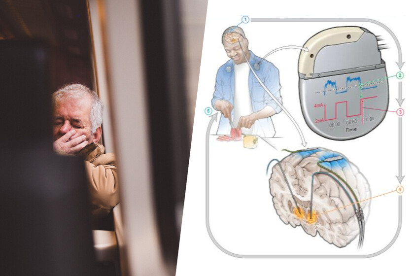 un “marcapasos” para el cerebro