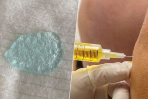 En la guerra contra la osteoartritis, un nuevo biomaterial desarrollado en China puede ser una poderosa arma