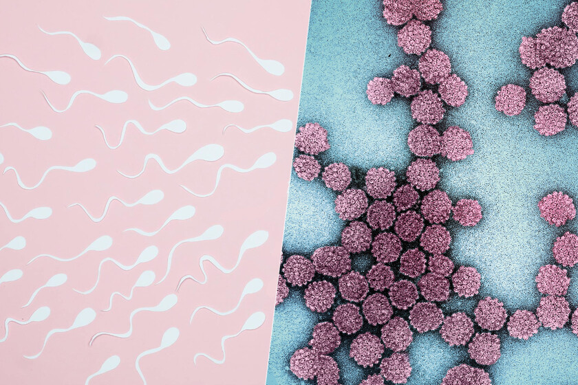 el virus del papiloma humano