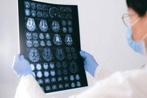 Cada vez más empresas están desarrollando chips cerebrales. California quiere proteger nuestra información neuronal con una ley