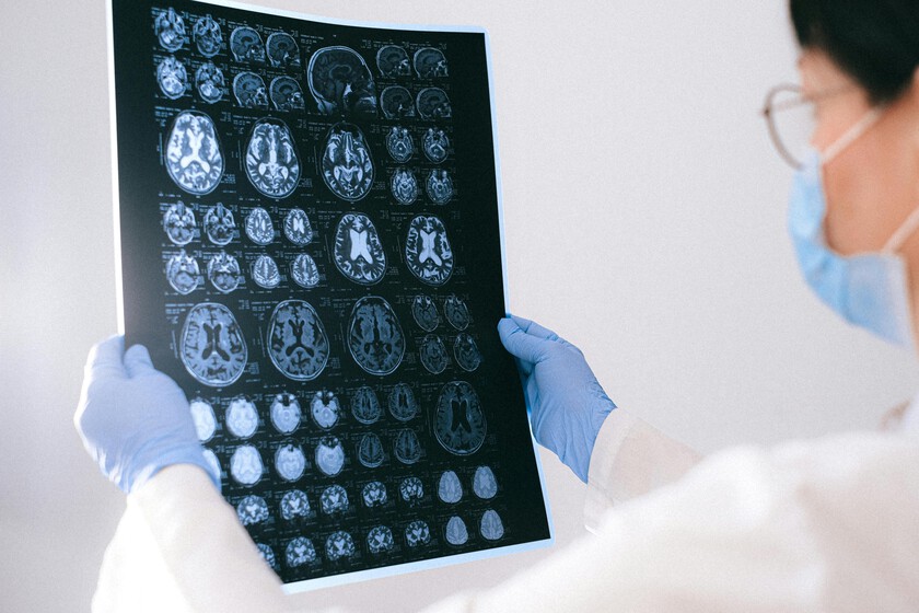Cada vez más empresas están desarrollando chips cerebrales. California quiere proteger nuestra información neuronal con una ley