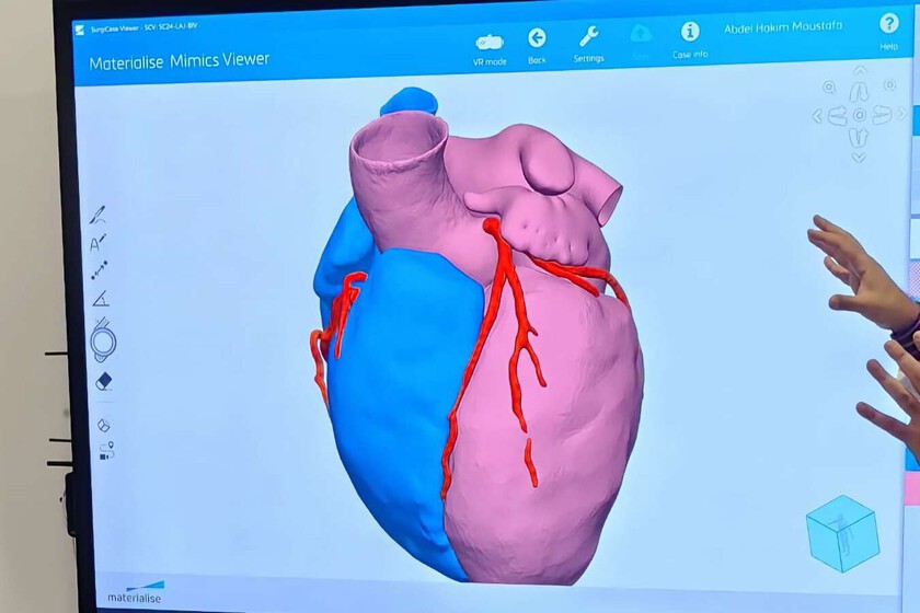 China necesita cardiólogos en una sociedad cada vez más envejecida. Su respuesta es una IA que "razona" como los mejores