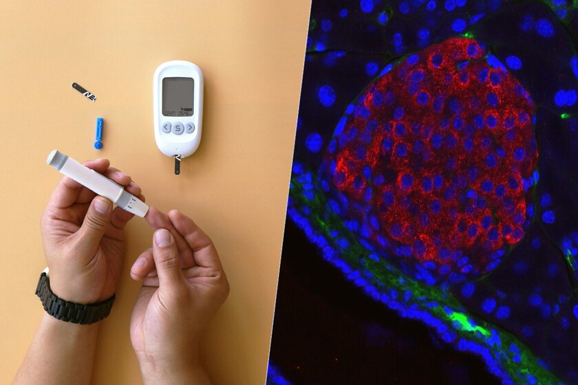 El futuro de la lucha contra la diabetes tipo 1 pasa por los trasplantes de islotes pancreáticos. Estamos solucionando sus limitaciones
