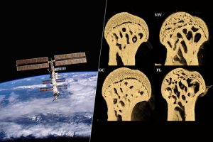 Hemos estudiado los huesos de unos ratones que pasaron 37 días en el espacio. Los resultados no son optimistas
