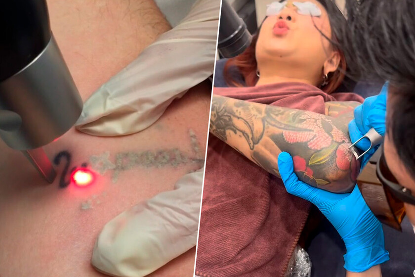 cada vez más jóvenes en España recurren a máquinas láser para borrarse tatuajes