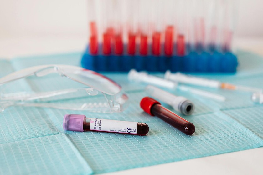Encontrar tests rápidos y fiables para el Alzheimer es una misión clave para la ciencia. Y tenemos un nuevo candidato