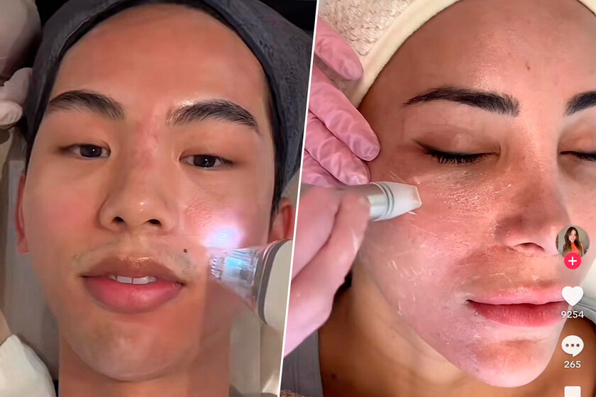 La gente está harta de los mil pasos del skincare así que la última tendencia beauty es solo una cosa: exosomas