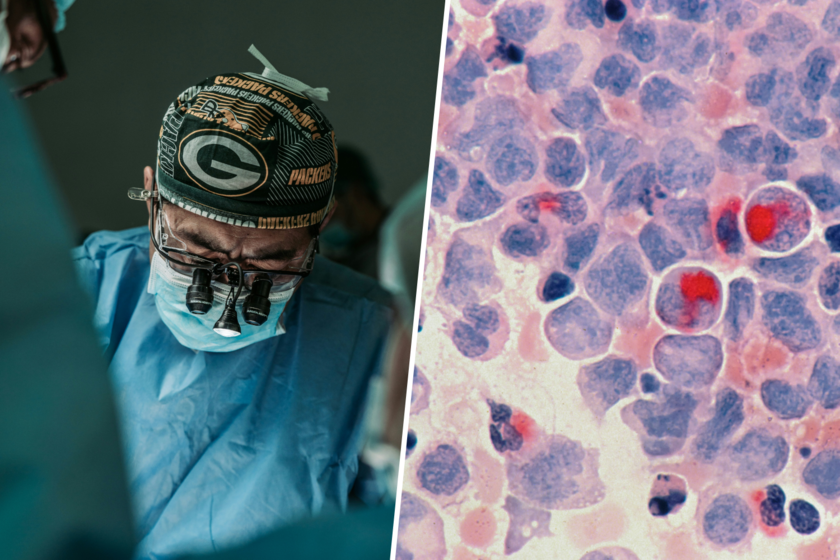 En los últimos 20 años, el cáncer colorrectal se ha duplicado entre los jóvenes sin saber por qué. Ahora tenemos pista