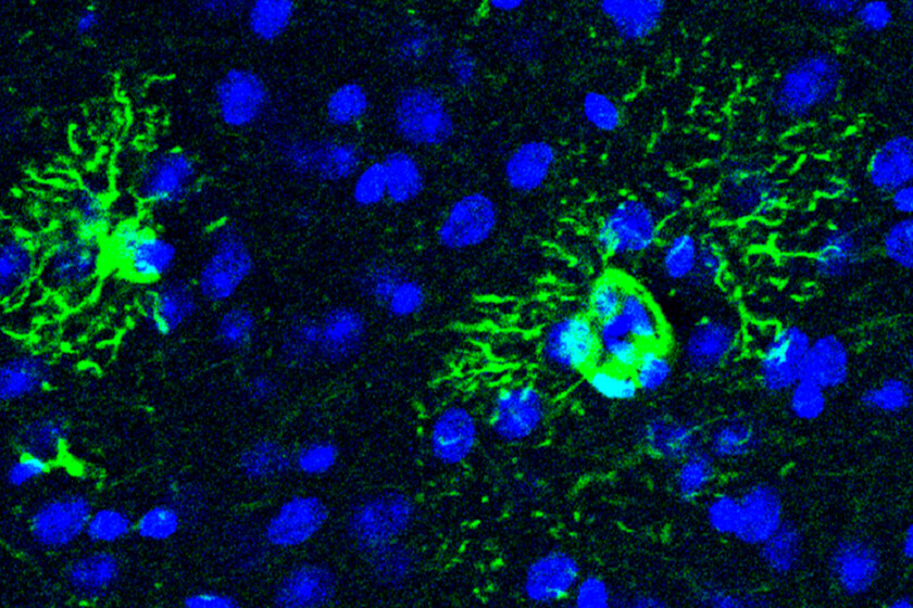 El Alzheimer comienza mucho antes que sus síntomas. Y hemos descubierto uno de sus primeros mecanismos
