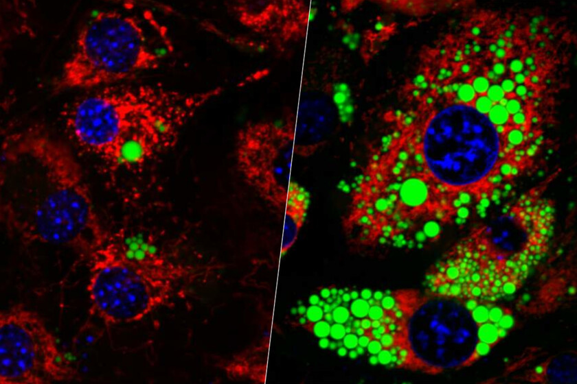 Perder peso sin perder músculo es el gran reto de fármacos como Ozempic. Una proteína guarda la clave para afrontarlo